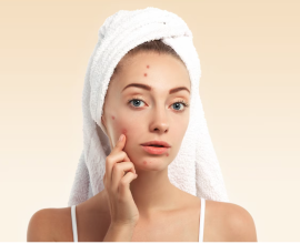 10 Tips Para Mawala ang Pimples: Forum na Gabay para sa Mas Malinis na Balat
