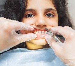 Best Dentist In Jaipur