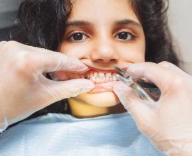 Best Dentist In Jaipur