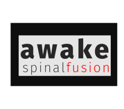 Awake Spinal Fusion