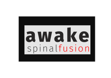 Awake Spinal Fusion