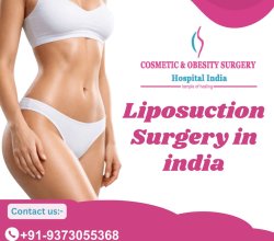Liposuction In India