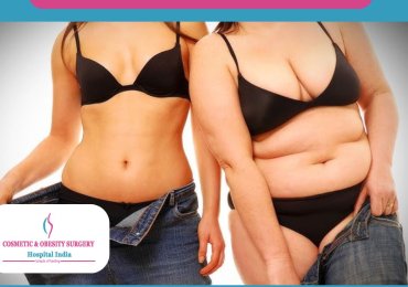 Affordable Mommy Makeover In India