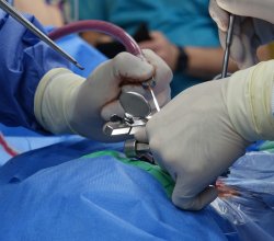 Finding the Right Orthopedic Surgeon in Union City: A Complete Guide