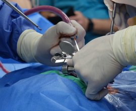 Finding the Right Orthopedic Surgeon in Union City: A Complete Guide