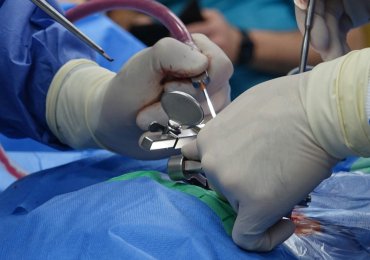 Finding the Right Orthopedic Surgeon in Union City: A Complete Guide