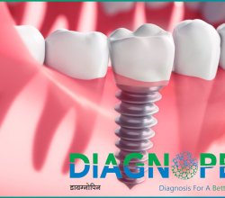 Free Dental Checkup Near Me | Comprehensive Oral Care in Pune