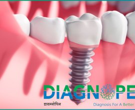 Free Dental Checkup Near Me | Comprehensive Oral Care in Pune