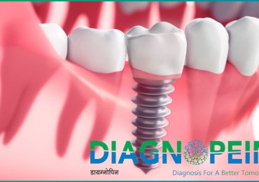 Free Dental Checkup Near Me | Comprehensive Oral Care in Pune