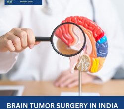 Brain Tumor Surgery in India