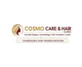 Chandigarh Hair Transplantation
