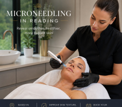 Microneedling in Reading