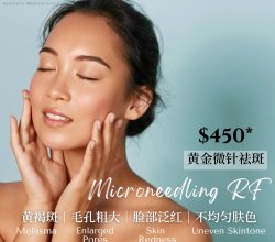 sylfirm x microneedling singapore