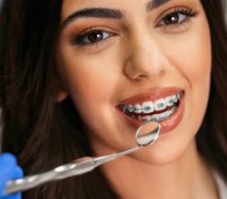 Dental Bridge Cost in India: Affordable Options & Treatment Guide
