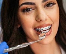 Dental Bridge Cost in India: Affordable Options & Treatment Guide