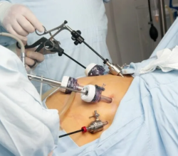 Fibroid Center of California Vascular and Interventional