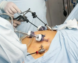 Fibroid Center of California Vascular and Interventional