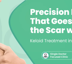 Trusted Keloid Treatment Near Me for Better Skin Health
