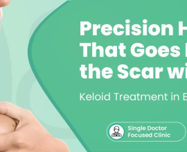Trusted Keloid Treatment Near Me for Better Skin Health
