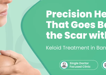 Trusted Keloid Treatment Near Me for Better Skin Health