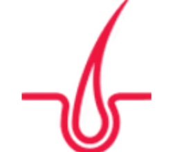 Medical Hair Loss Center NJ