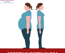 Cost of Bariatric Surgery in Goa
