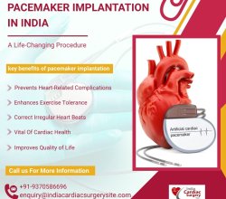 Low Cost Pacemaker Implantation Surgery India