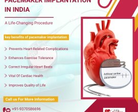 Low Cost Pacemaker Implantation Surgery India