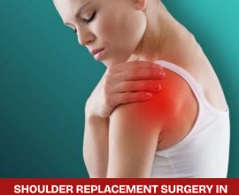 Low Cost Shoulder replacement Surgery in India