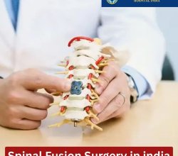 Best Spine Fusion Treatment in India