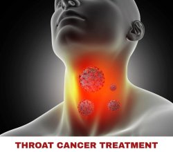 Best Throat Cancer Surgeons in India