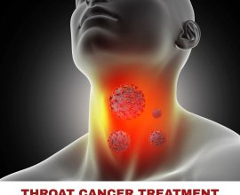 Best Throat Cancer Surgeons in India