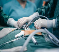 California Thyroid Center – Thyroid RFA Ablation Specialist