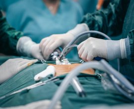 California Thyroid Center – Thyroid RFA Ablation Specialist