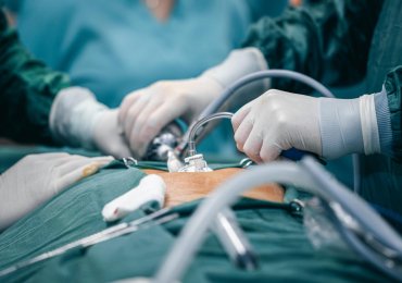 California Thyroid Center – Thyroid RFA Ablation Specialist