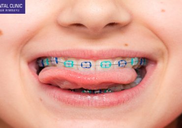 Full-Arch Reconstruction and the End of Removable Dentures