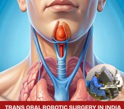 Best TORS Robotic Surgery Doctors in India