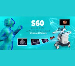 Best Medical Equipment Company In India | SonoScape India