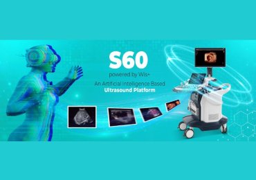 Best Medical Equipment Company In India | SonoScape India