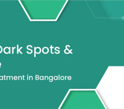 Best Pigmentation Treatment in Bangalore – Is Anew Bangalore Effective?