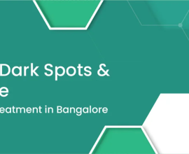 Best Pigmentation Treatment in Bangalore – Is Anew Bangalore Effective?