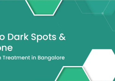 Best Pigmentation Treatment in Bangalore – Is Anew Bangalore Effective?