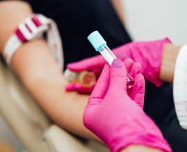 Home Blood Collection Centre Near Me for Convenient Testing