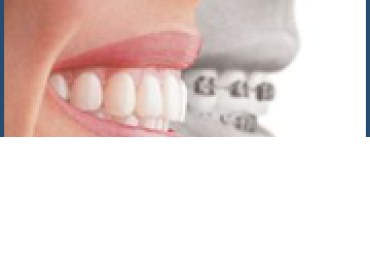 Low Cost Dental Surgery in India