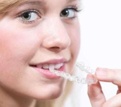 The Ultimate Guide to Orthodontic Treatments & Costs in Chennai