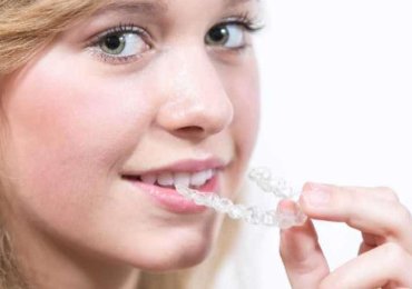 The Ultimate Guide to Orthodontic Treatments & Costs in Chennai