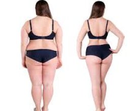 Ibd Functional Medicine Doctor Vero Beach