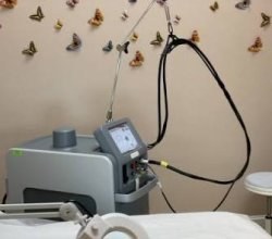 Laser Treatment For Hair Removal Pleasanton
